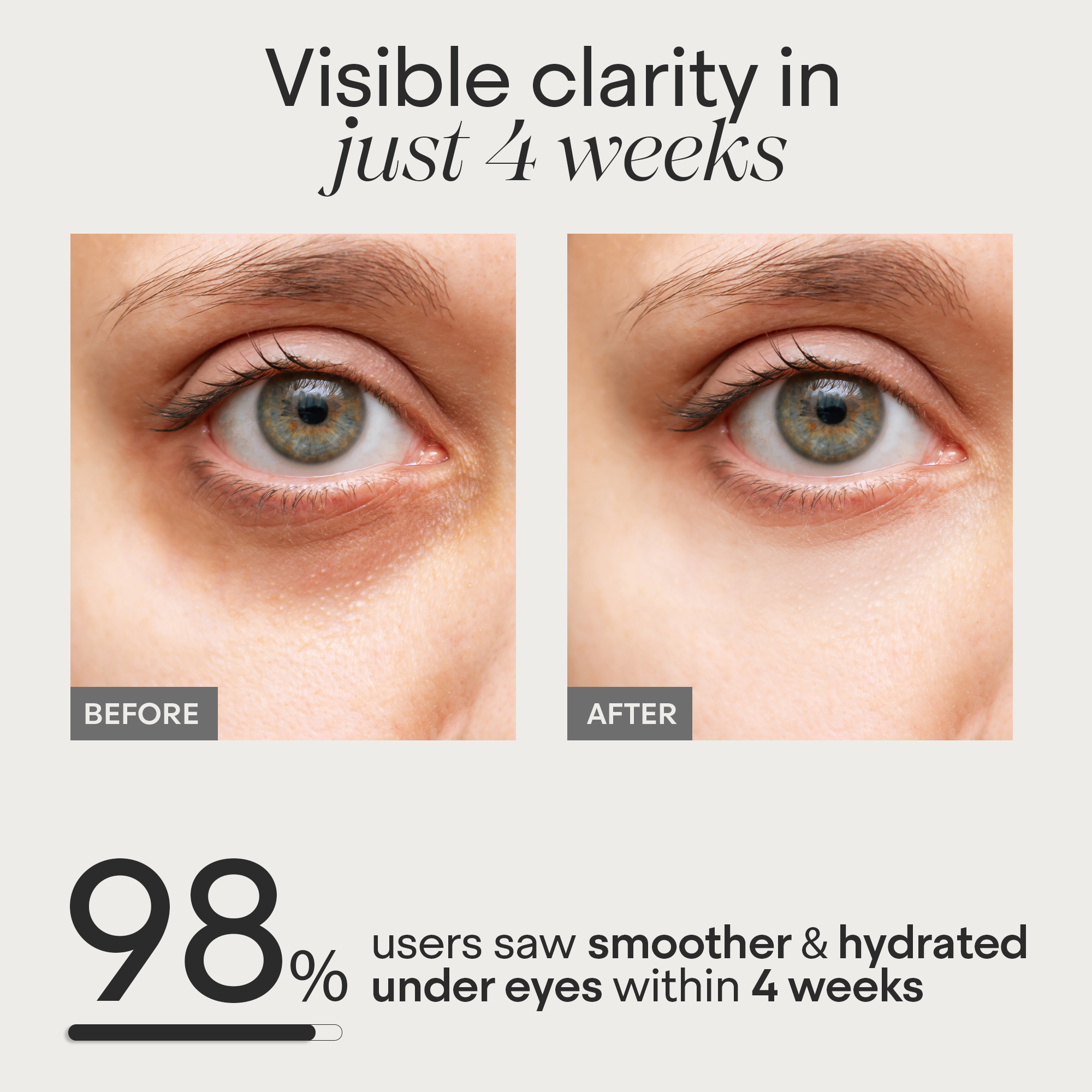 Under Eye Puffiness & Dark Circle Correction Cream