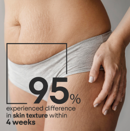 Skin Restore Stretch Marks & Scar Repair Cream