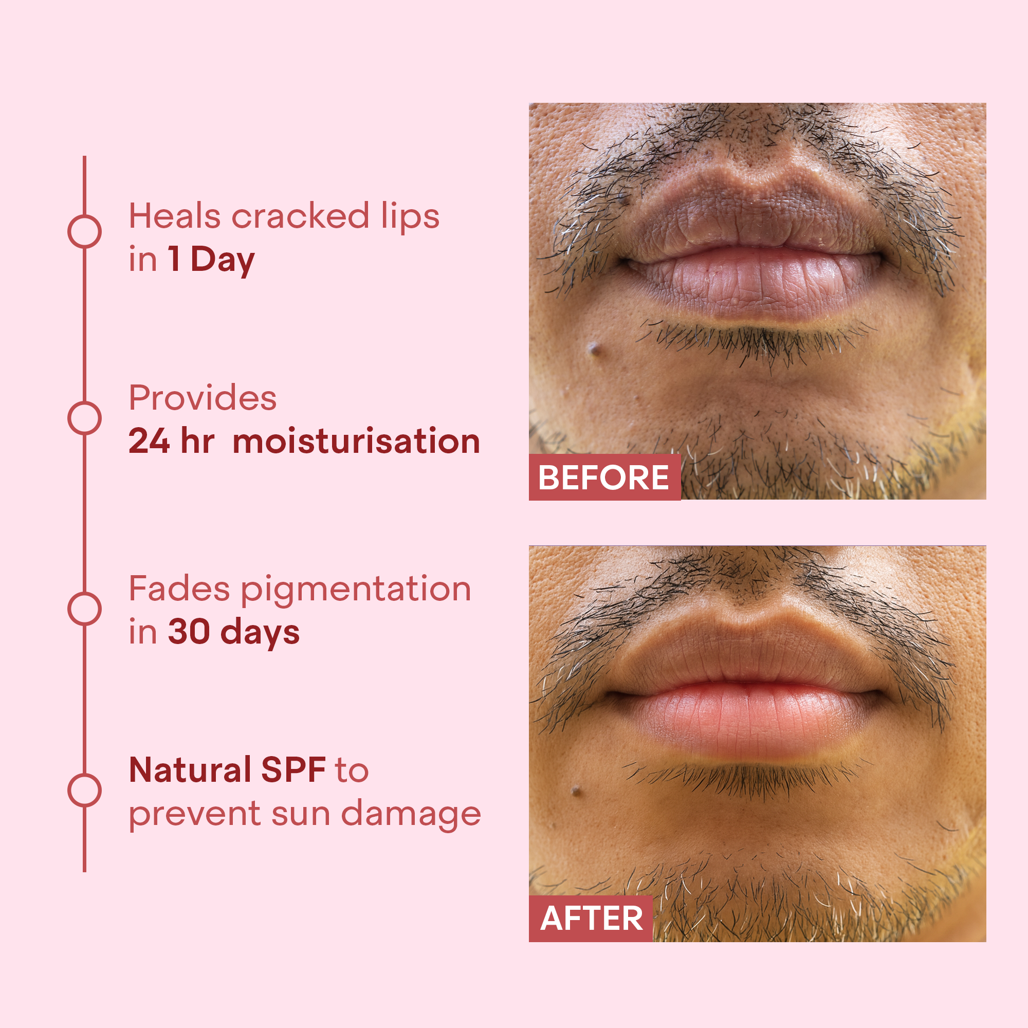 Lip Repair Balm For Pigmentation, Dryness &amp; Cracked Lips