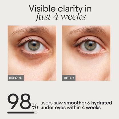 Under Eye Puffiness &amp; Dark Circle Correction Cream