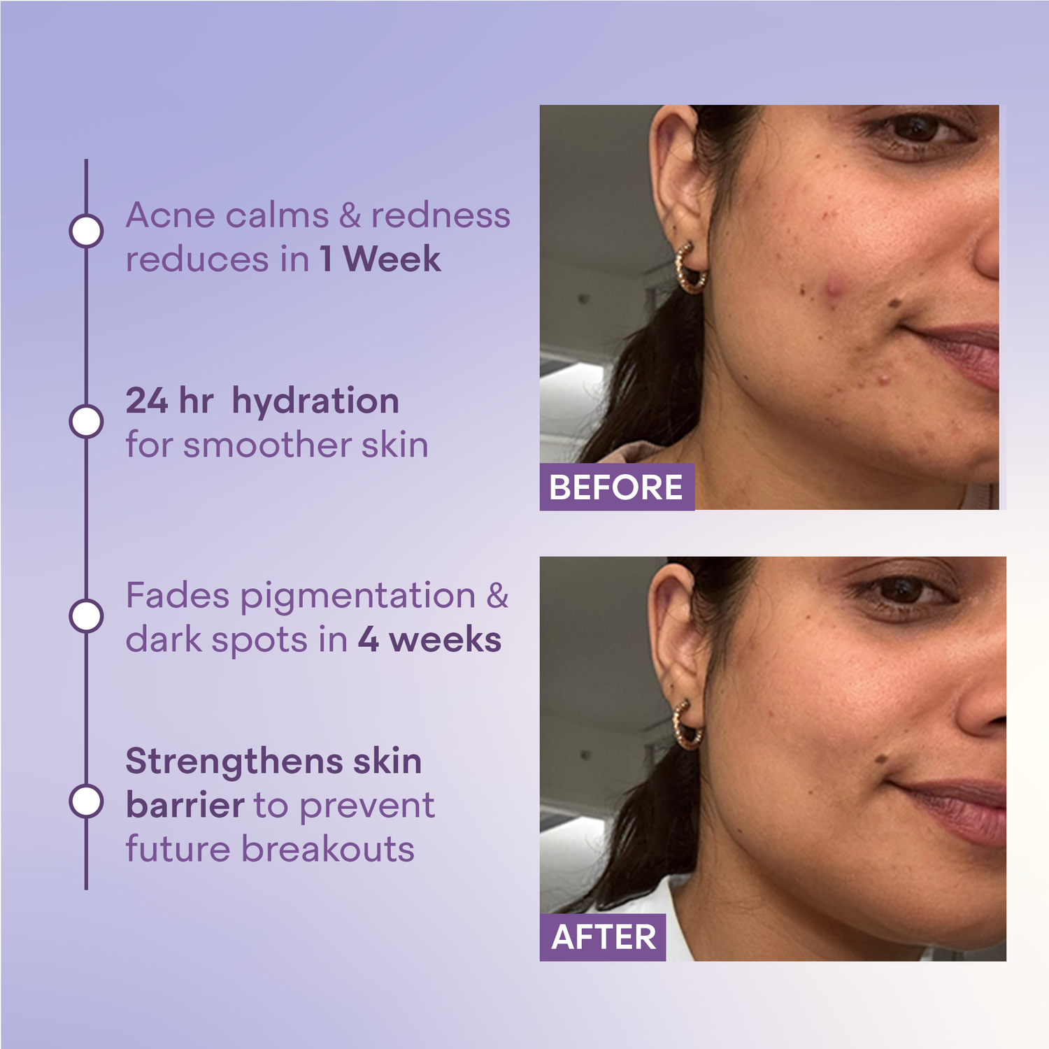 Kozmi Clear Anti-Acne &amp; Brightening Face Serum