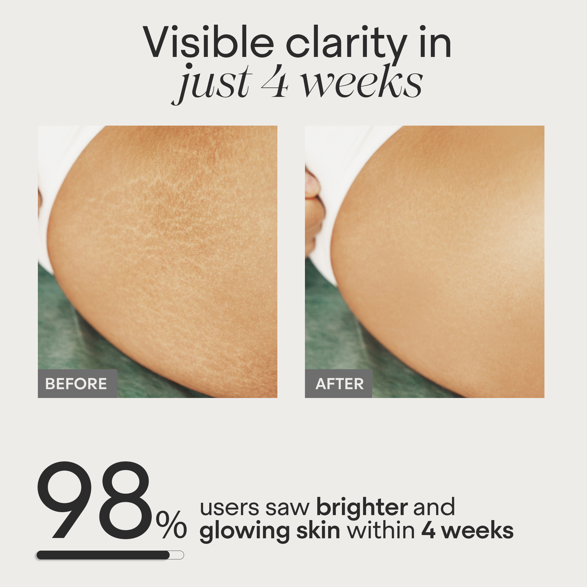 Skin Restore Stretch Marks &amp; Scar Repair Cream