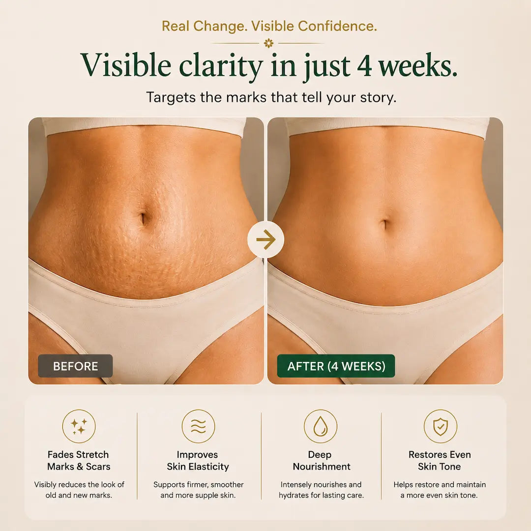 Skin Restore Stretch Marks &amp; Scar Repair Cream
