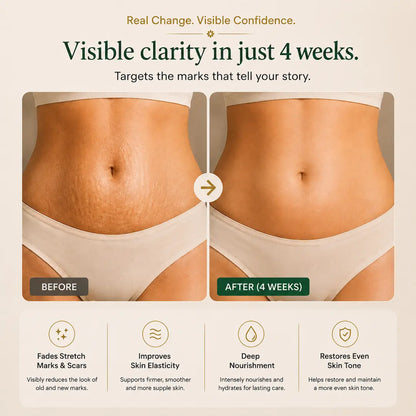 Skin Restore Stretch Marks &amp; Scar Repair Cream