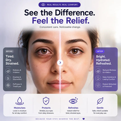 Credolube Daily Eye Comfort Drops for Dry &amp; Screen-Tired Eyes - Pack of 5 bottles