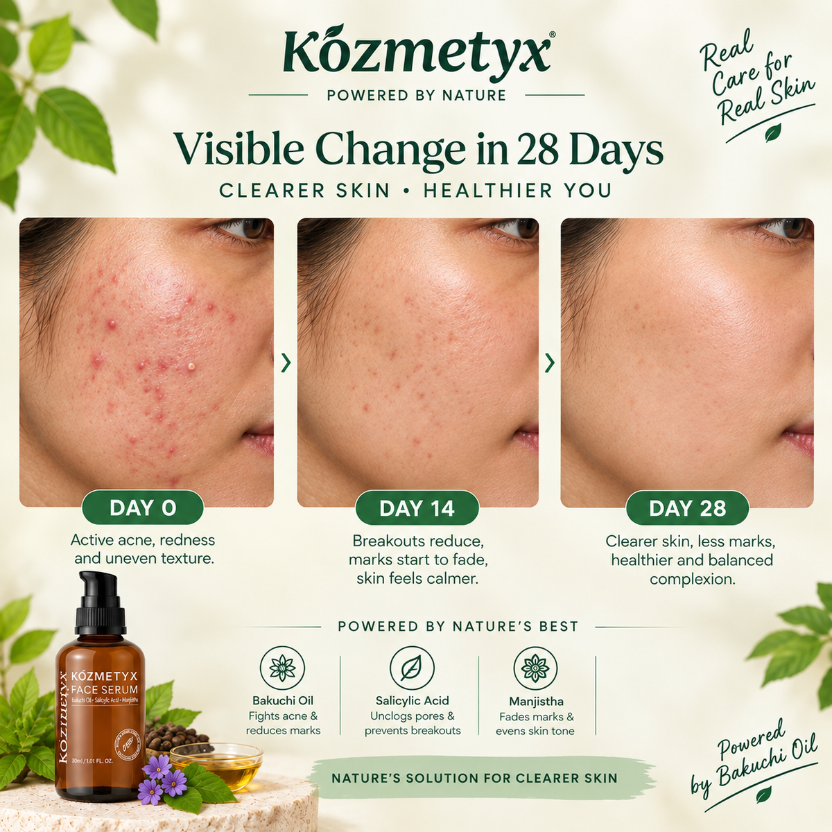 Kozmi Clear Anti-Acne &amp; Brightening Face Serum