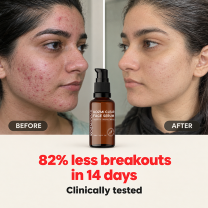 Kozmi Clear Anti-Acne &amp; Brightening Face Serum