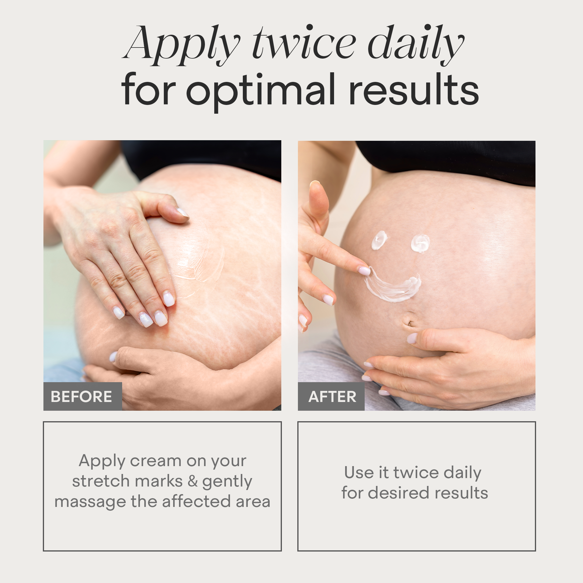 Skin Restore Stretch Marks &amp; Scar Repair Cream