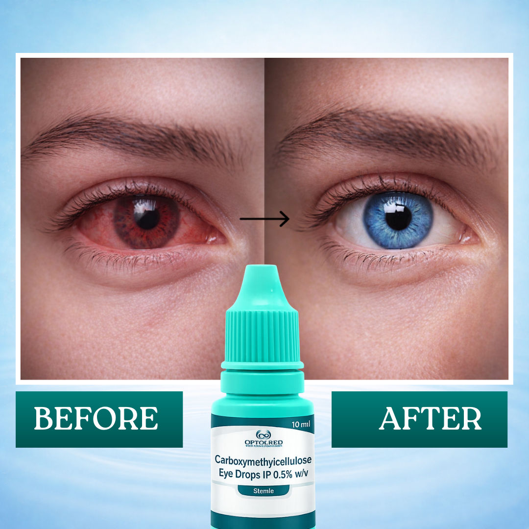 Credolube Daily Eye Comfort Drops for Dry &amp; Screen-Tired Eyes - Pack of 5 bottles